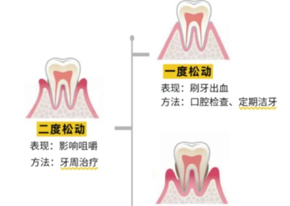 老年人牙齒松動(dòng)了要怎么辦？