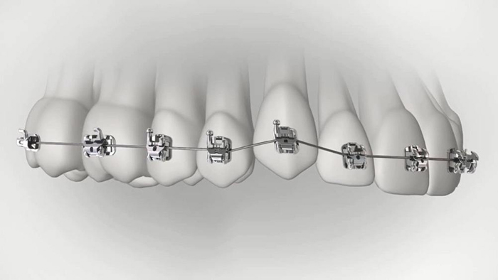 承德市哪家口腔醫(yī)院口腔正畸做得好？惟德口腔醫(yī)院來告訴您