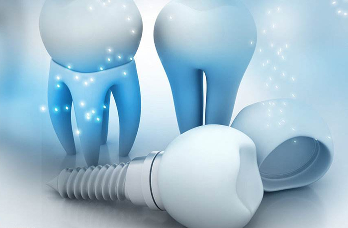 惟德口腔醫(yī)院口腔種植價格表一覽2020