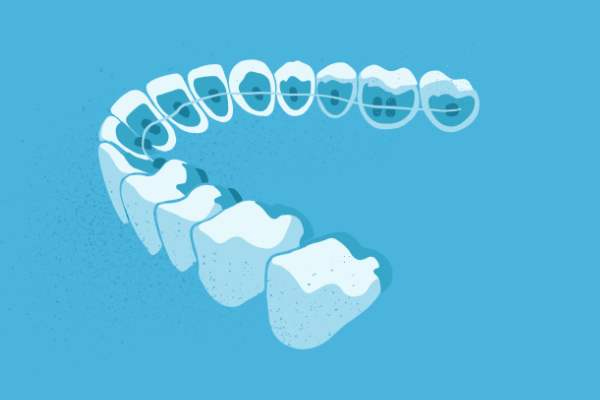 惟德口腔醫(yī)院口腔正畸好不好？